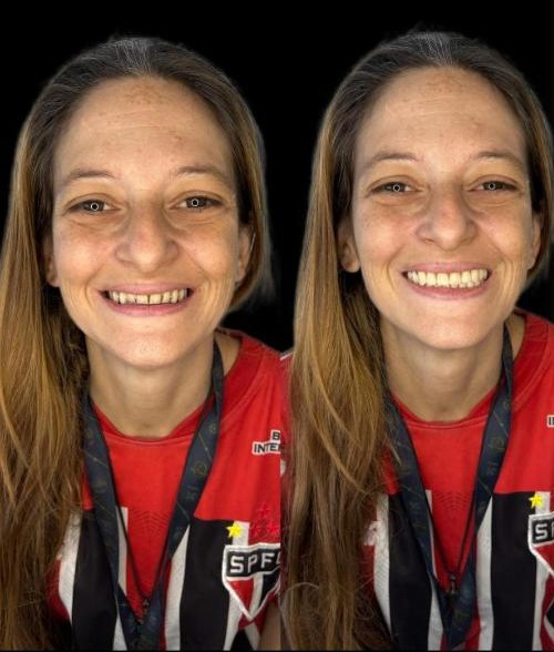 Antes e depois de tratamento odontológico